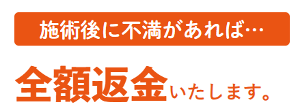 【激安】スターホワイトニングで何回で白くなる？驚きの真実を解説！